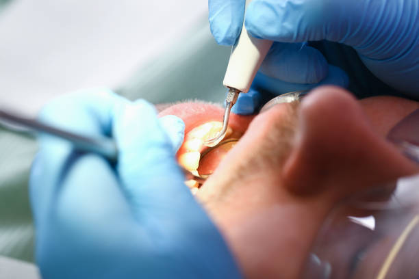 Best Emergency Treatment for Toothache in Hope, AR