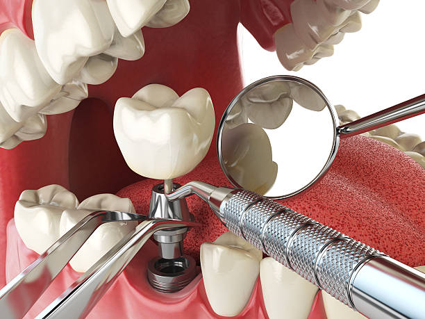 Best Emergency Treatment for Toothache in Hope, AR